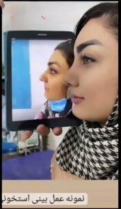 Screenshot_۲۰۲۴۱۲۲۲_۱۱۳۱۱۵_Instagram-1