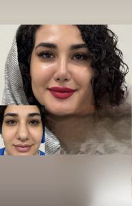 Screenshot_۲۰۲۵۰۱۲۶_۱۶۰۸۱۳_Instagram-1